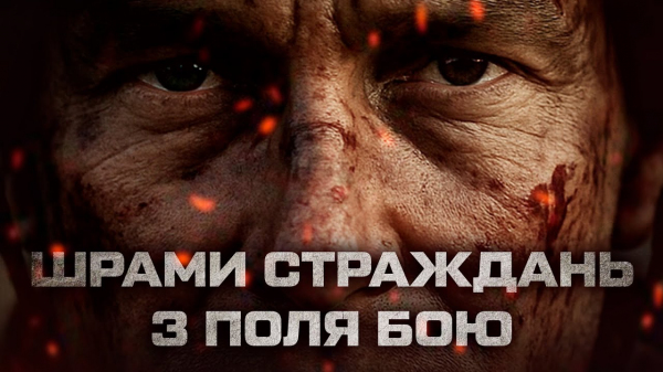 Шрами страждань з поля бою